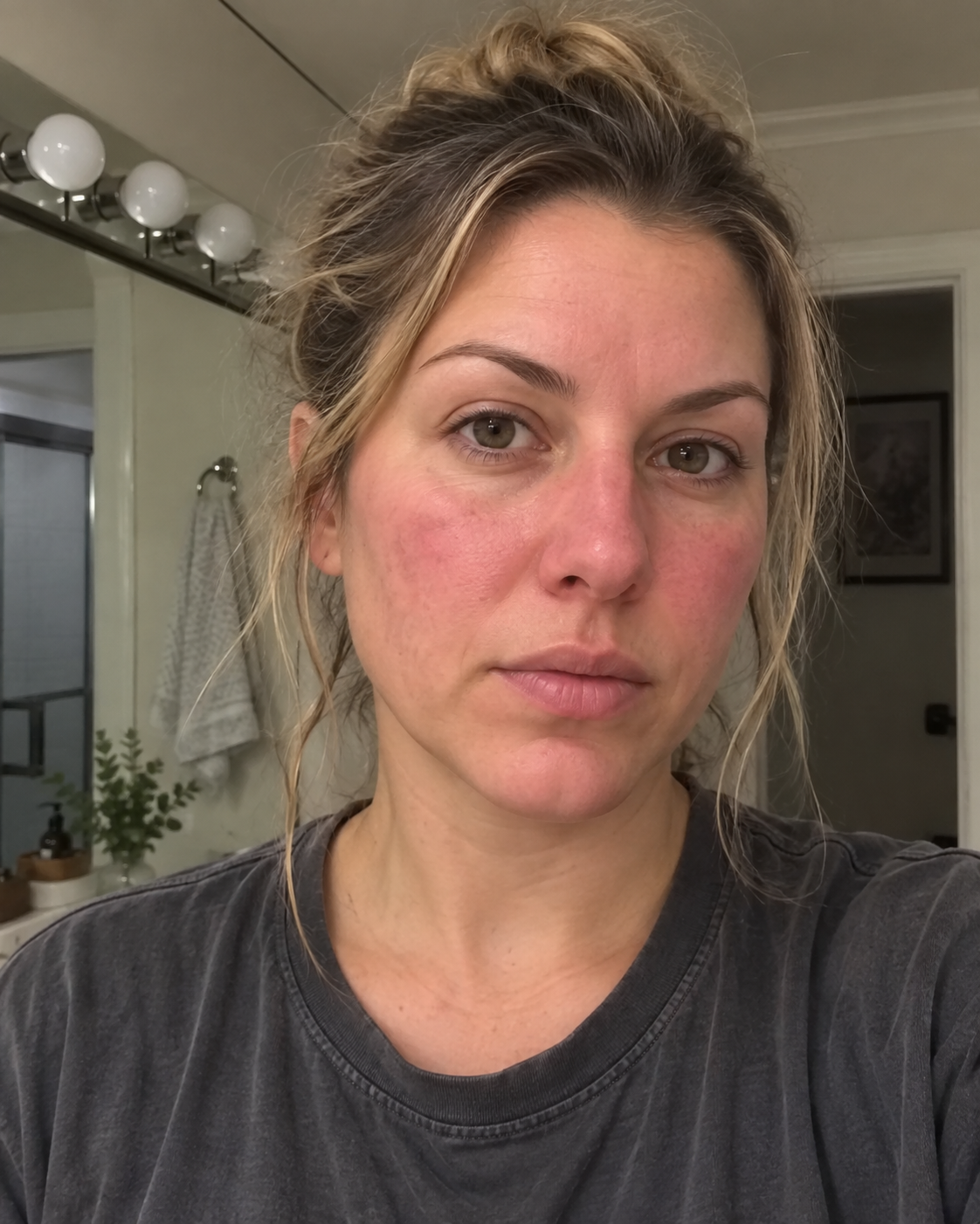 Customer review — facial redness before using Calmora