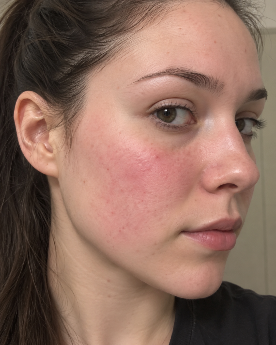 Customer review — facial redness before using Calmora